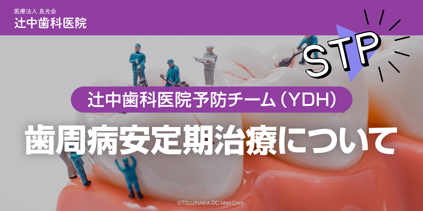 歯周病安定期治療について | 摂津市千里丘でマウスピース矯正・予防