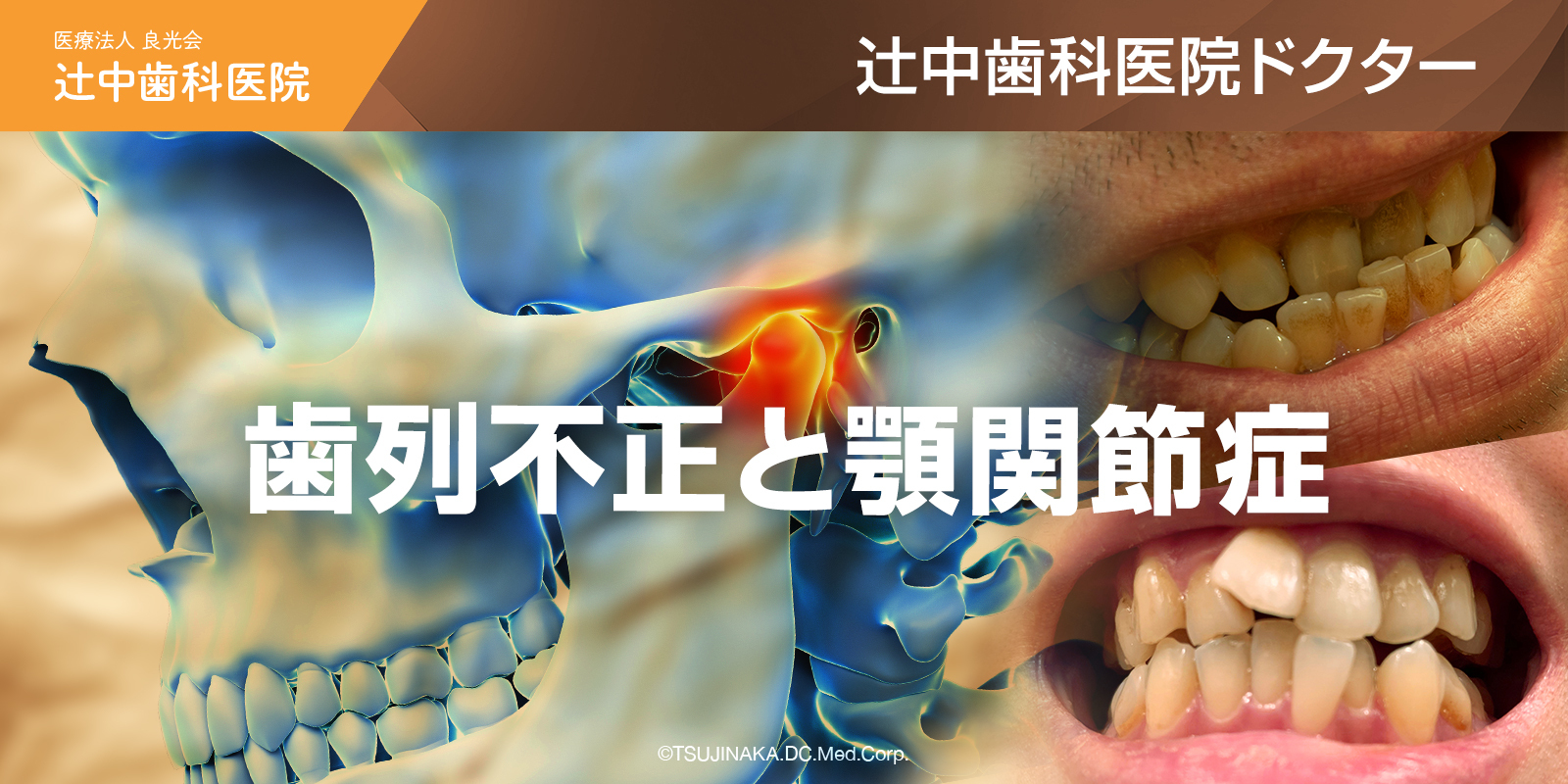 顎関節症はどのように治療されますか?