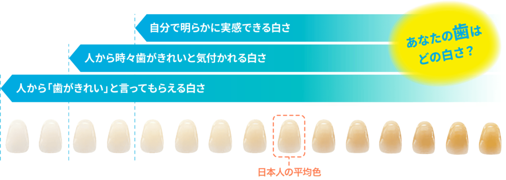 あなたの歯はどの白さ？