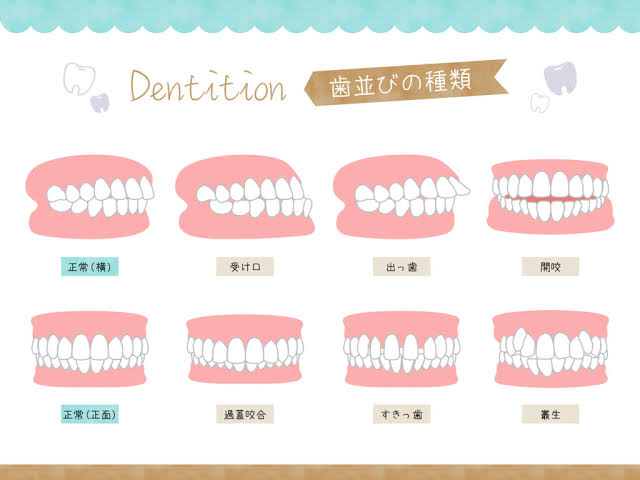 Types of tooth alignment