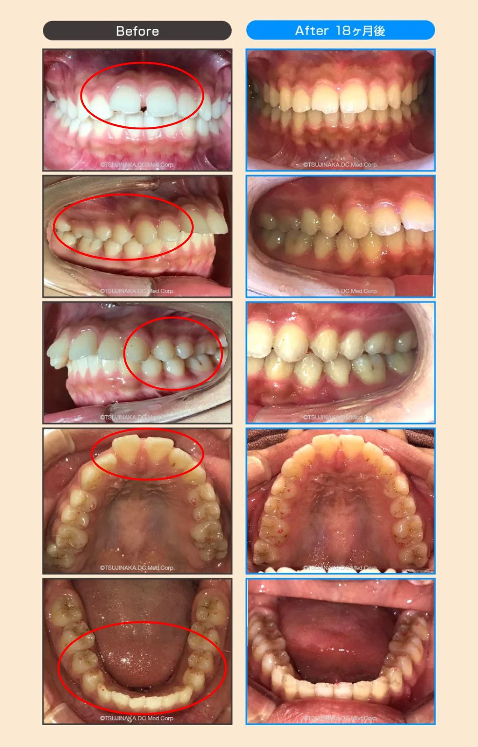 治療後の比較画像