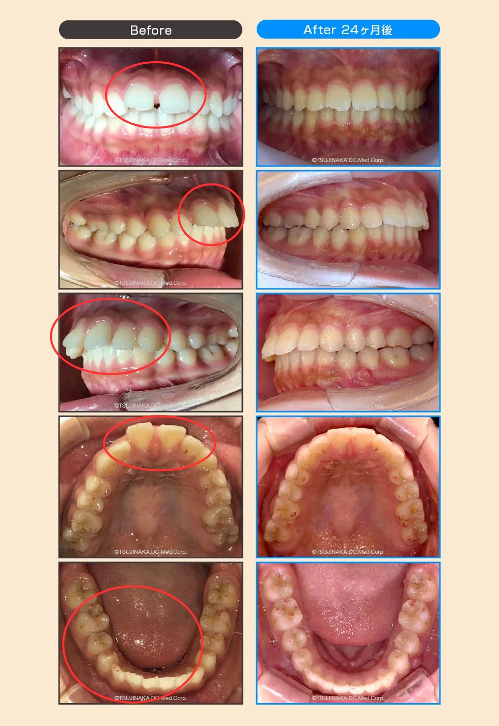 治療後の比較画像