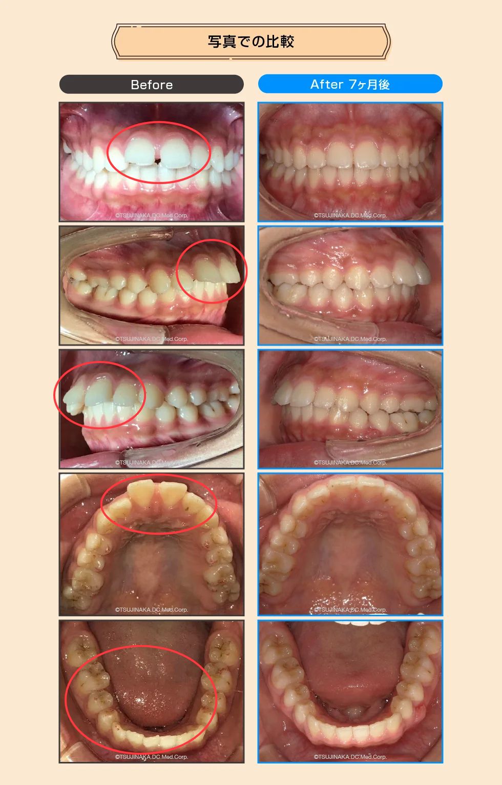 治療後の比較画像