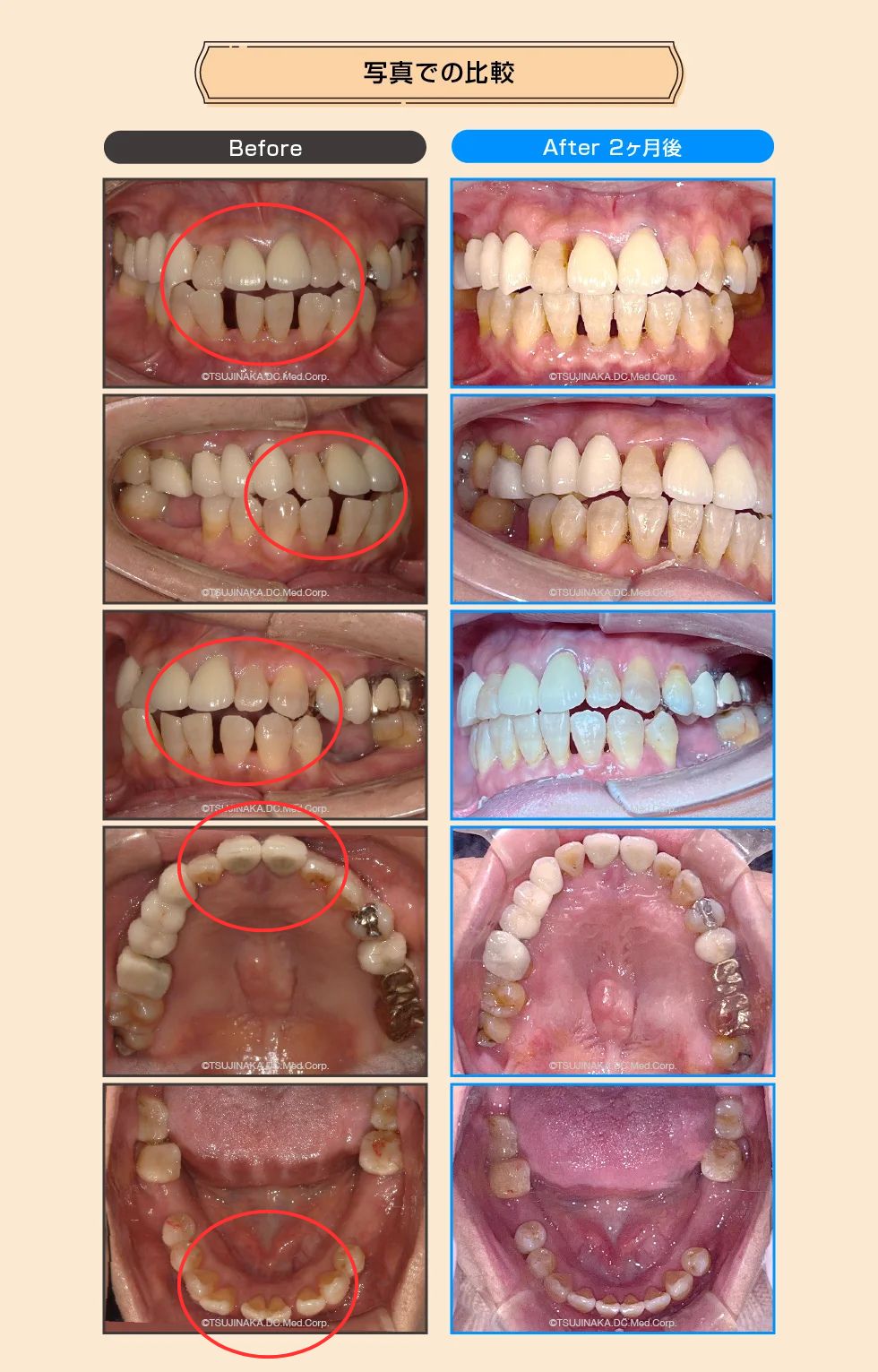 治療後の比較画像