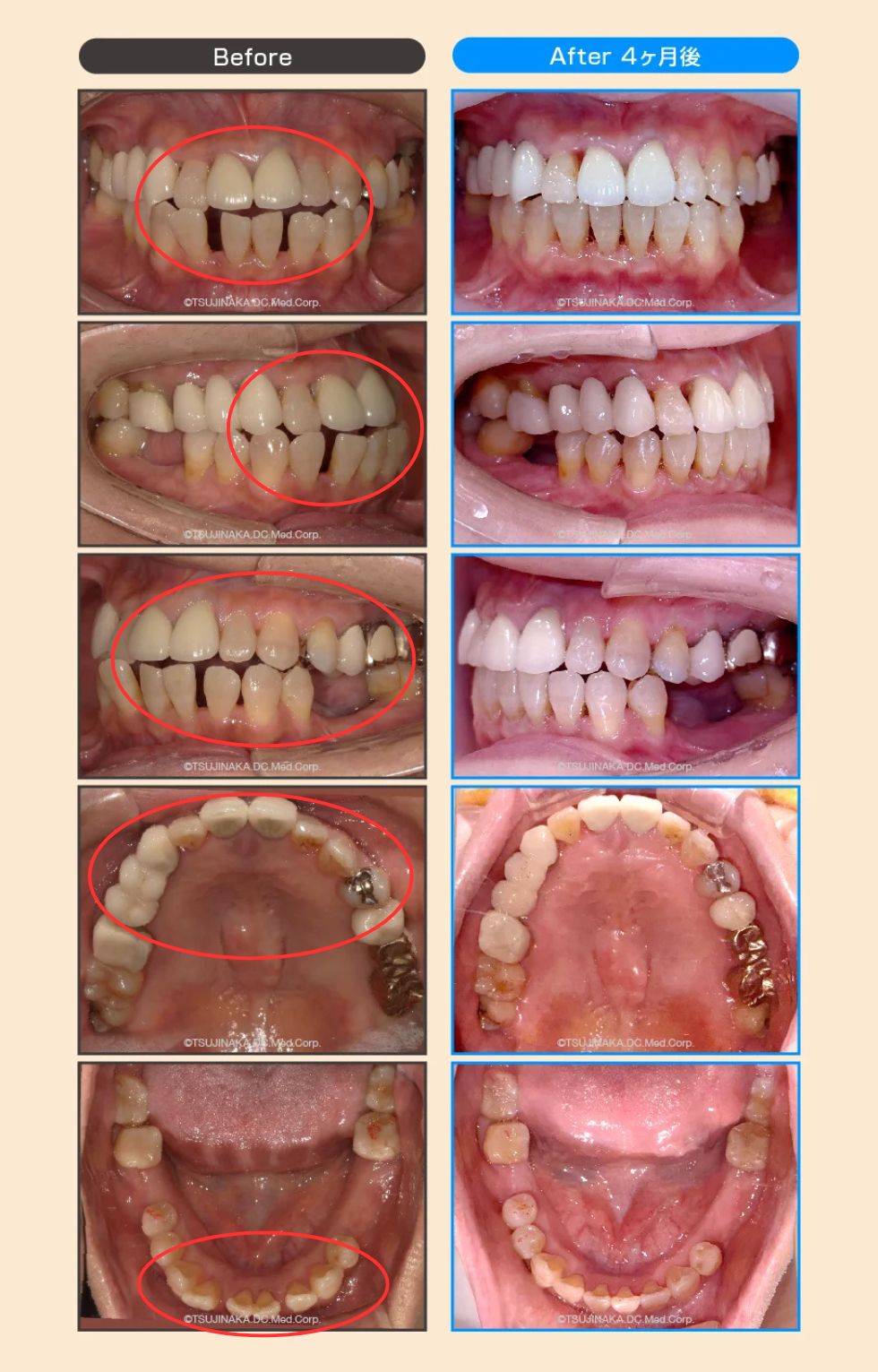 治療後の比較画像