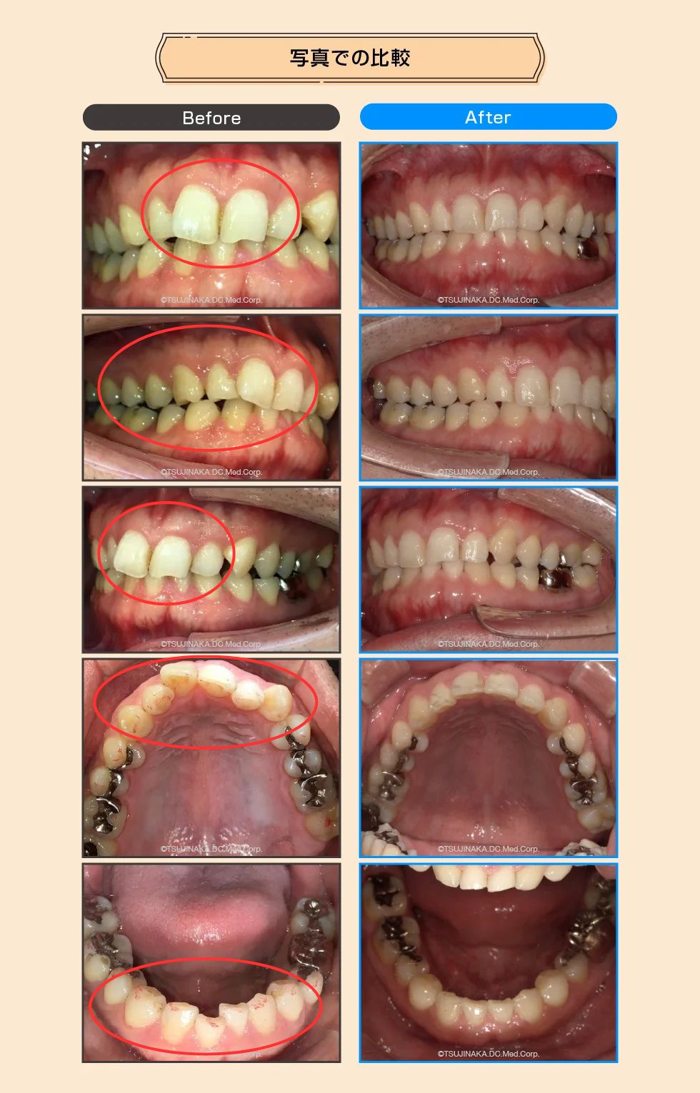 治療後の比較画像