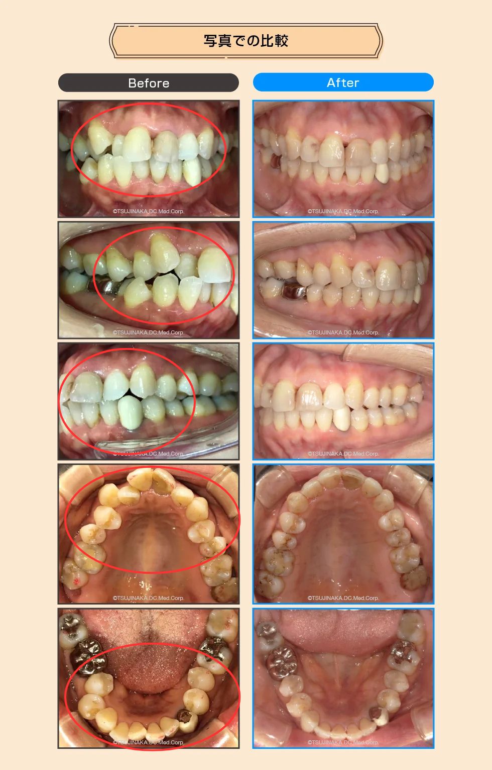 治療後の比較画像