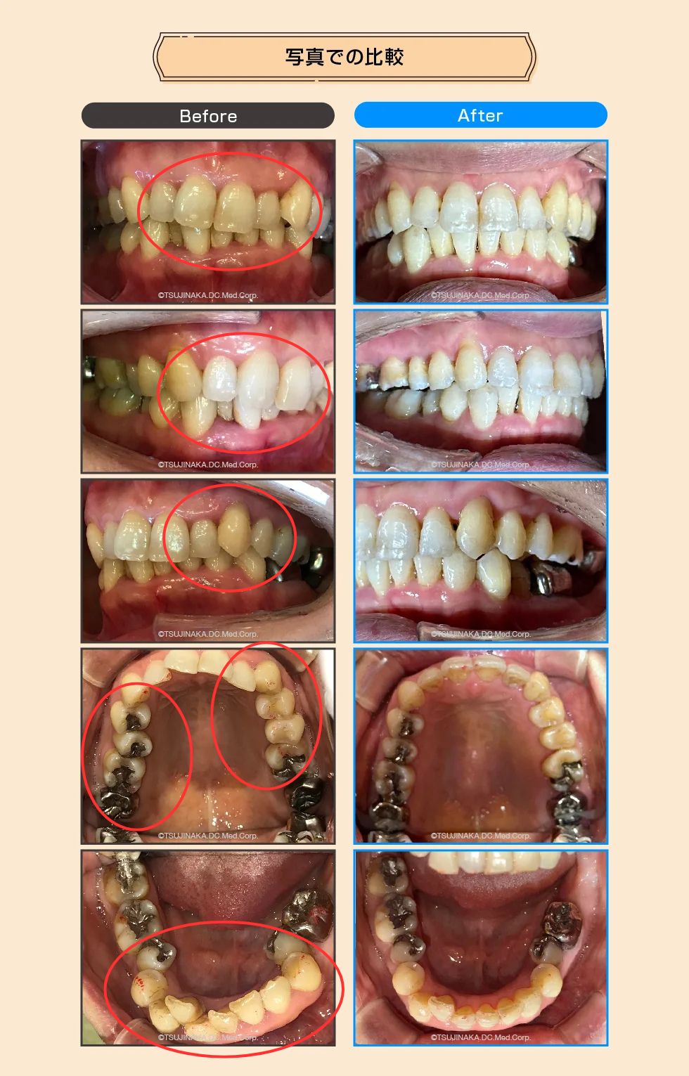 治療後の比較画像