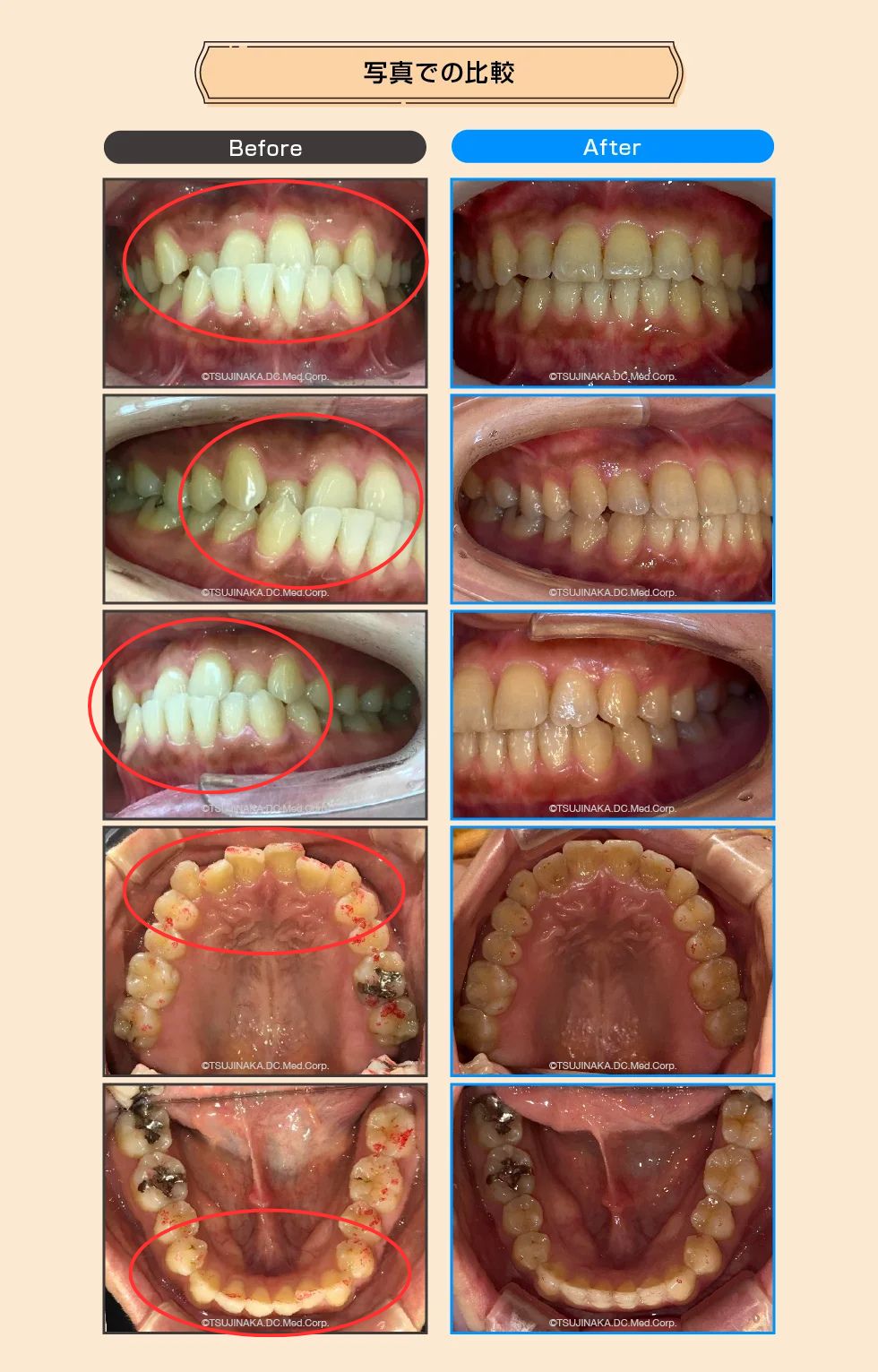 治療後の比較画像