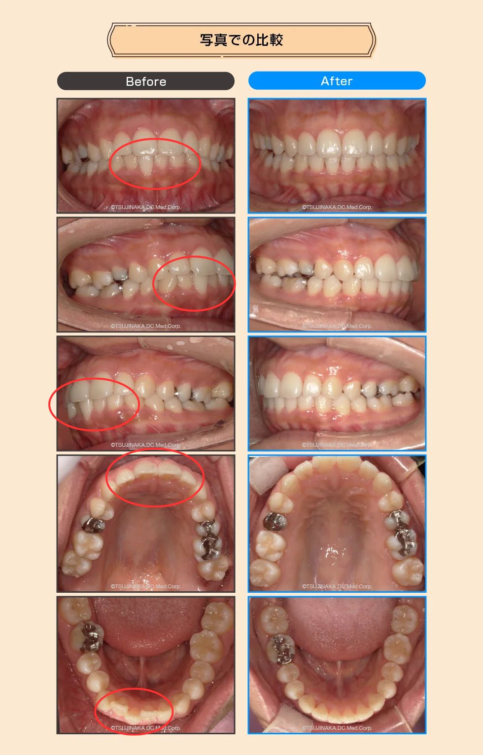治療後の比較画像