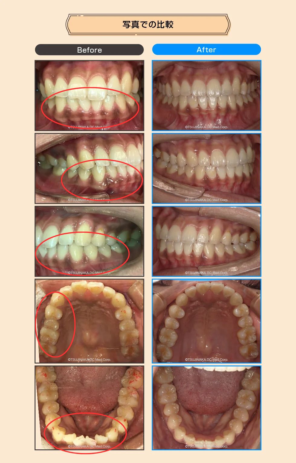 治療後の比較画像