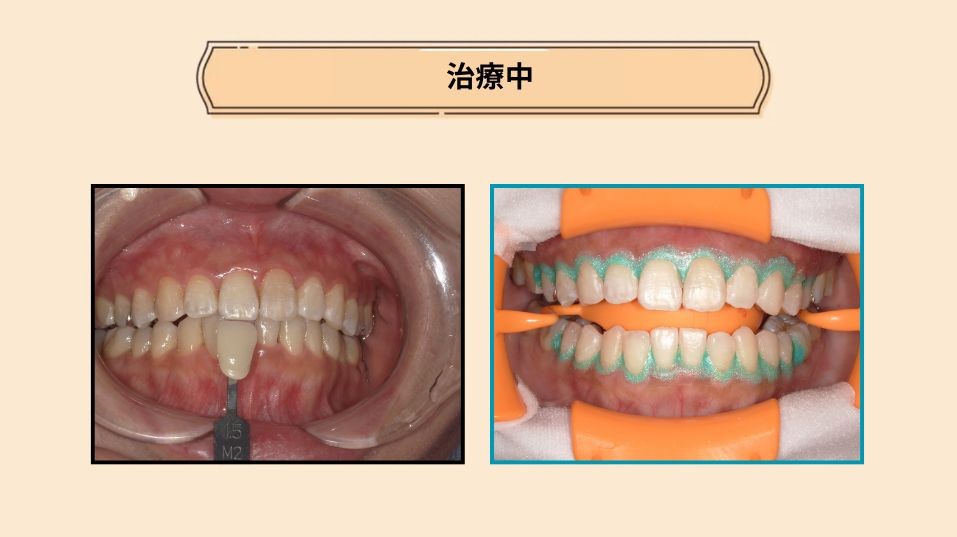 治療後の比較画像