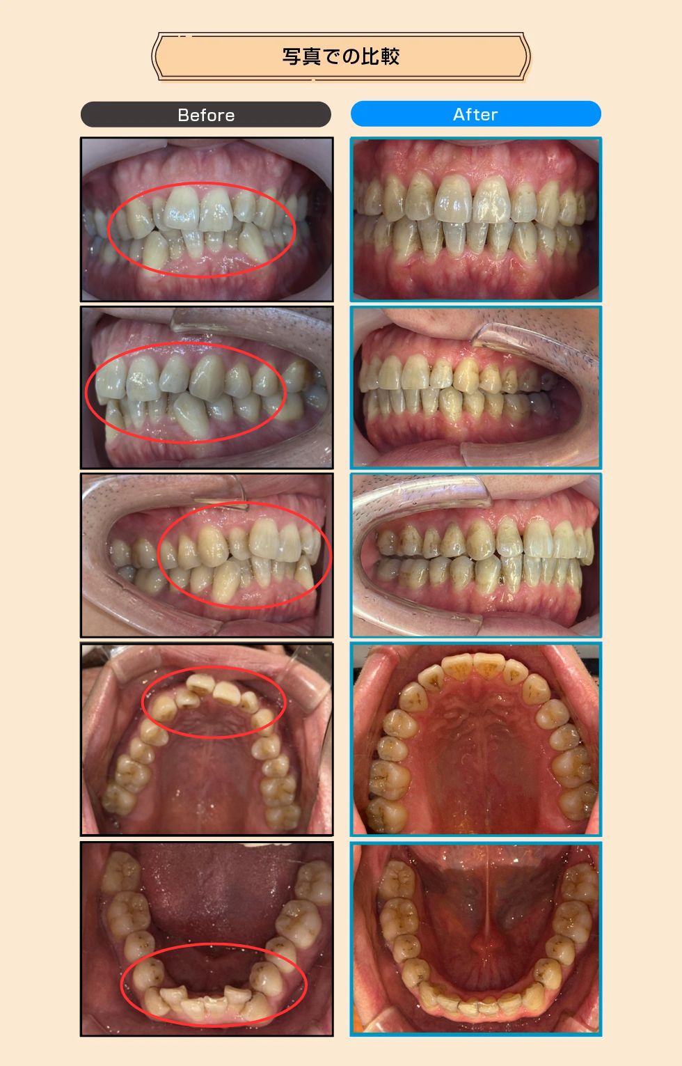 治療後の比較画像